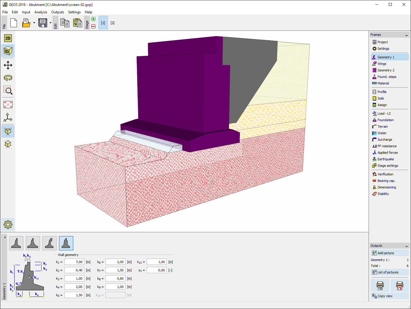 Abutment : 3D view